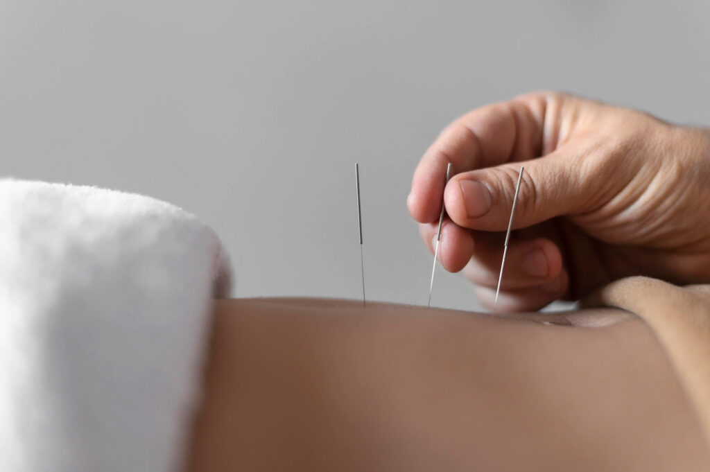 <strong>Akupunkturu Türkler mi Keşfetti?</strong>